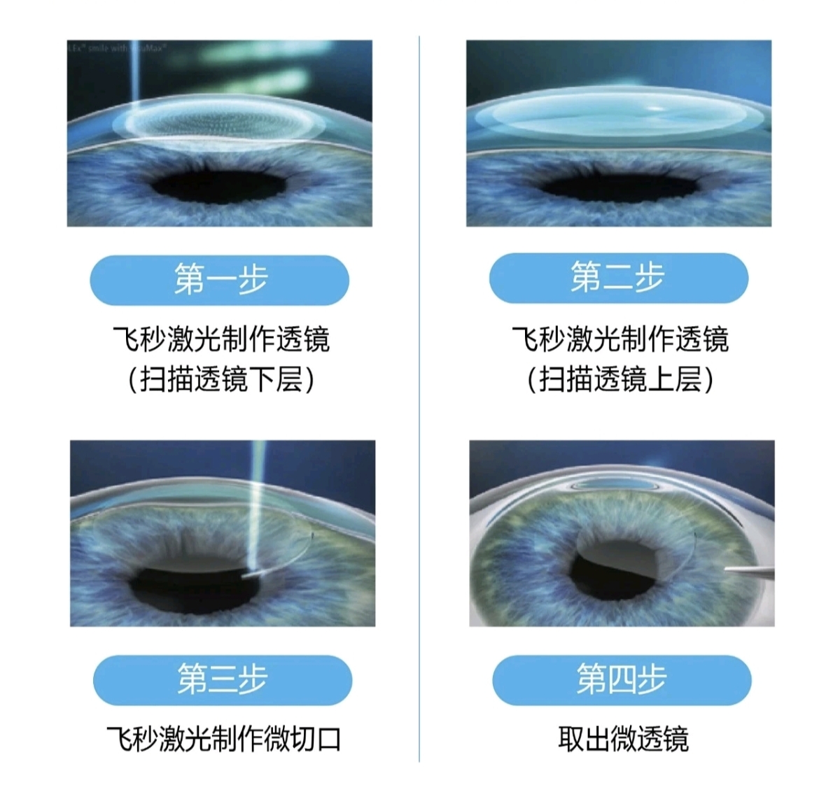 7f4014fe0c5c984cbd28dc6a7590654f_origin(1)